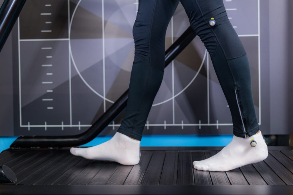 Gait Analysis and Insoles converted